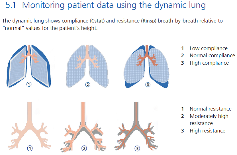 Hamilton T1 transport ventilator set-up guide & pre-use checks