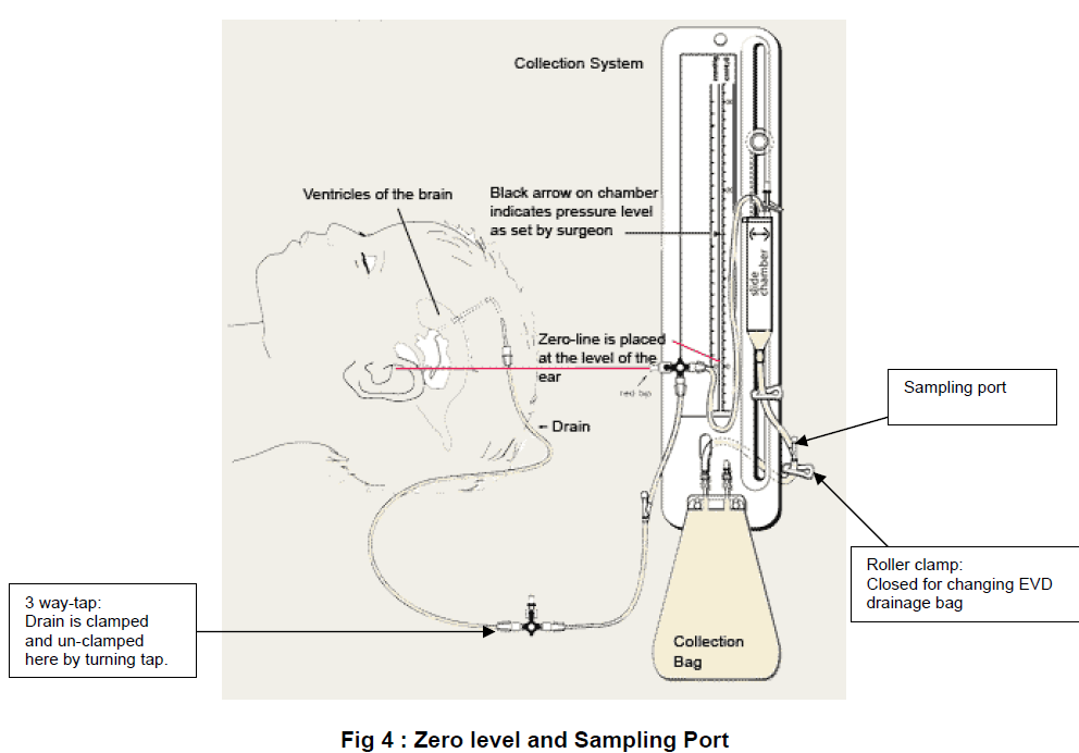 How Does An Evd Drain Work Best Drain Photos