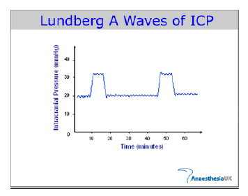 Lundberg A Waves of ICP
