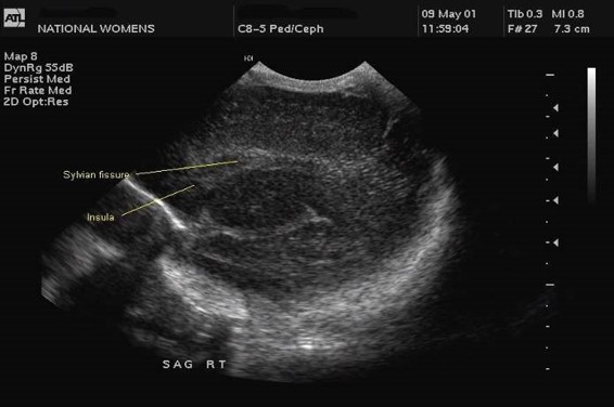 ultrasound image