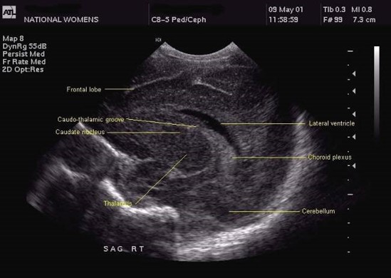ultrasound image