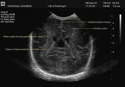 ultrasound image