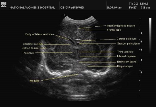 ultrasound image