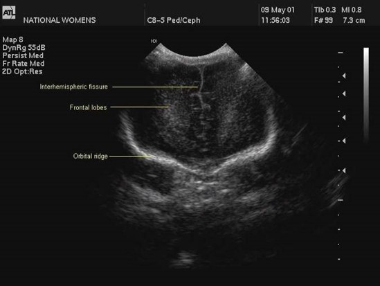 ultrasound image