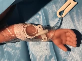 Image of Upper Limb PICC placement