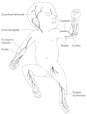 Image of common PICC placement sites