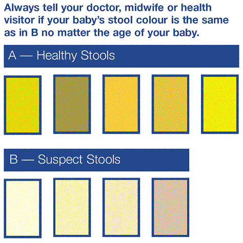 Infant Stool Colour Chart - Best Picture Of Chart Anyimage.Org