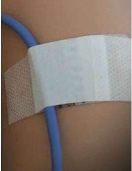 Probe secured to the body with tape