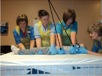 Indicating assistant 1's correct hand positioning