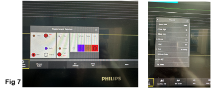ICP monitoring fig 7